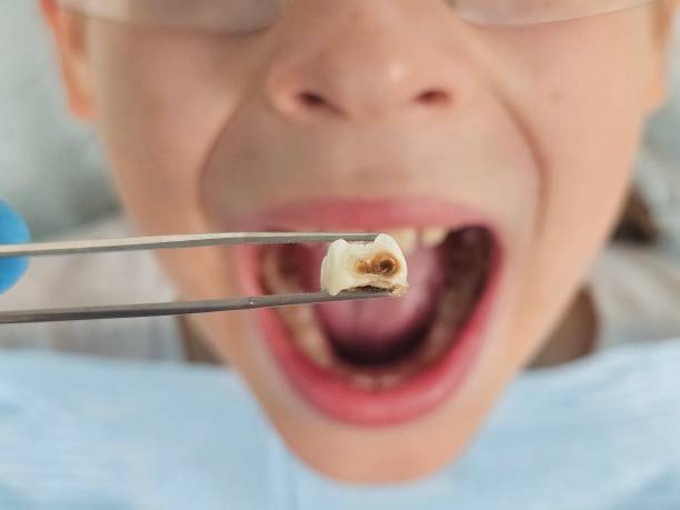 Best Emergency Pediatric Dental Care in Pontotoc, MS